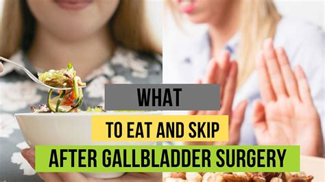 This is mostly in extreme cases and after the gallstones have not passed for several days. . Can i eat garlic after gallbladder removal